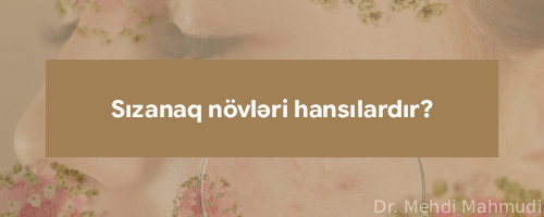 sizanaq novleri hansilardir?