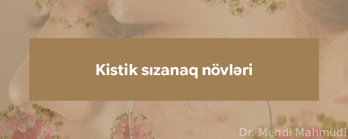 Kistik sizanaq novleri