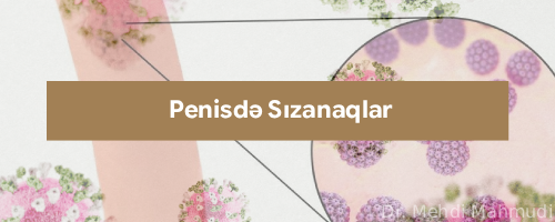 Penisdə Sızanaqlar