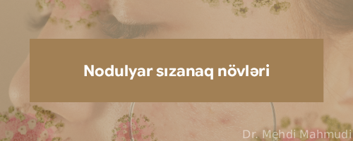 Nodulyar sizanaq novleri