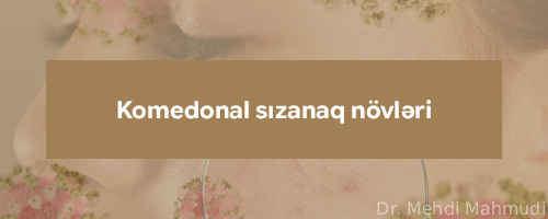 Komedonal sızanaq n&ouml;vleri