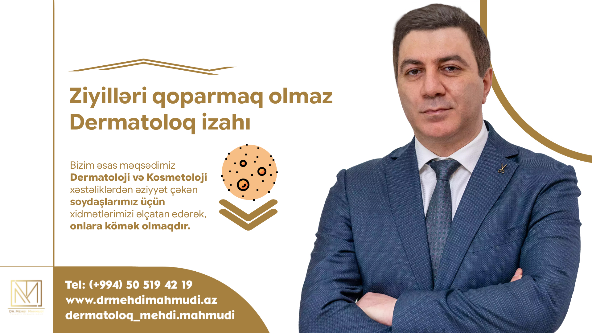 Ziyilləri qoparmaq olmaz