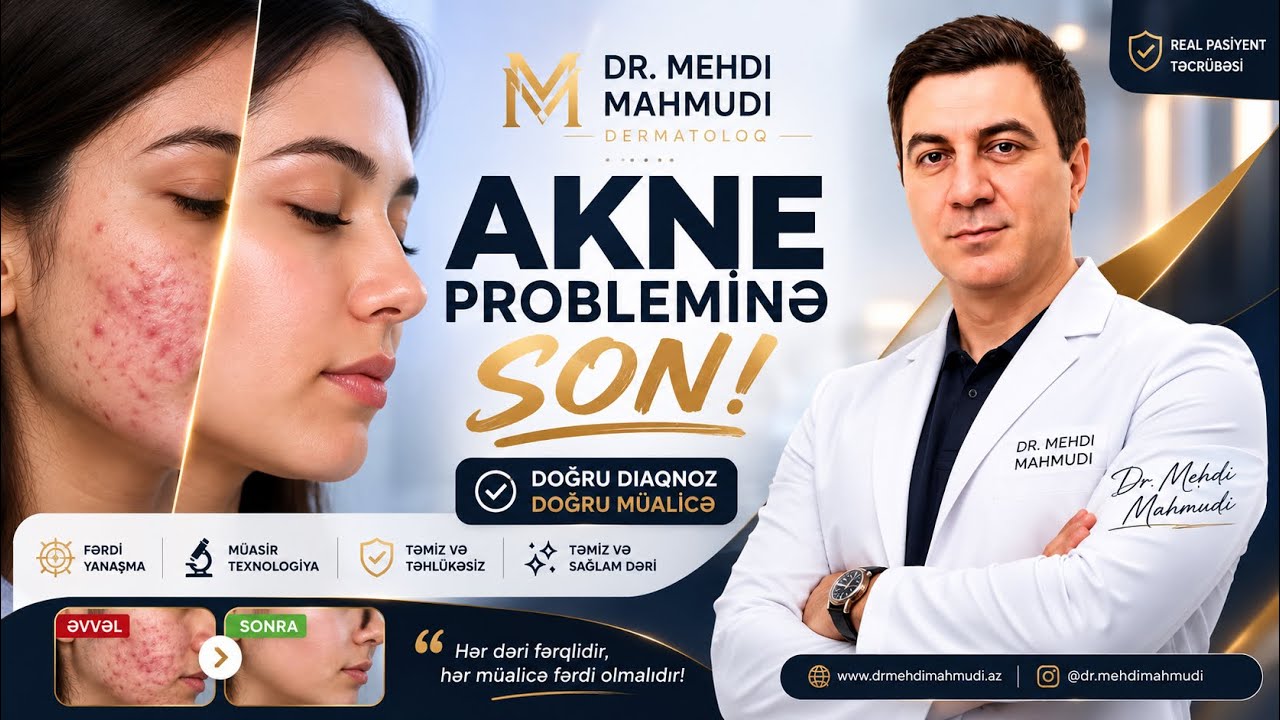 Üzdəki Aknelər Niyə Yaranır? Sızanaqların Səbəbləri və Müalicəsi | Dr. Mehdi Mahmudi