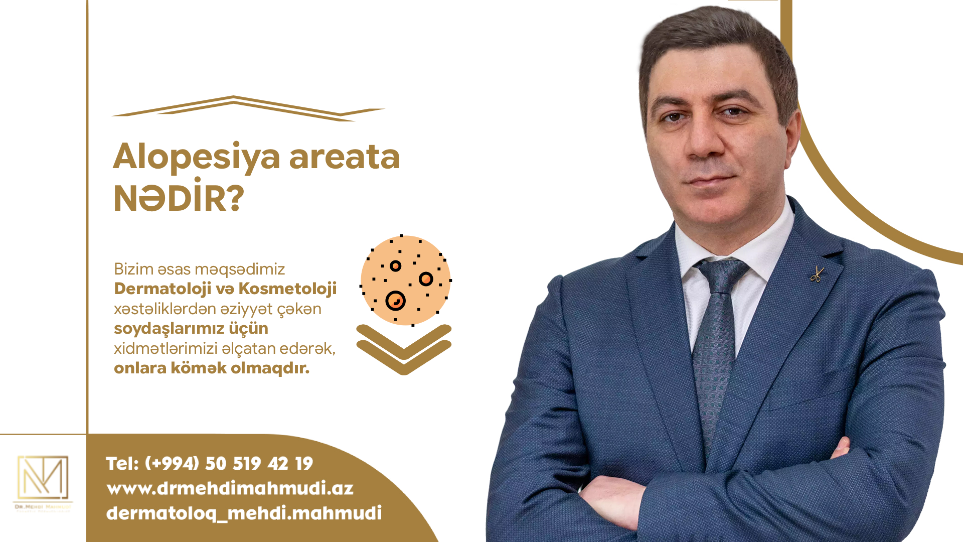 Alopesiya areata nədir?
