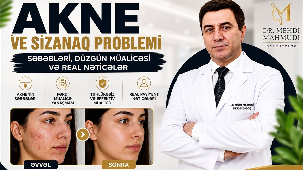 Üzdəki Sızanaqlardan Necə Qurtulmaq Olar? | Aknenin Səbəbləri və Düzgün Müalicə