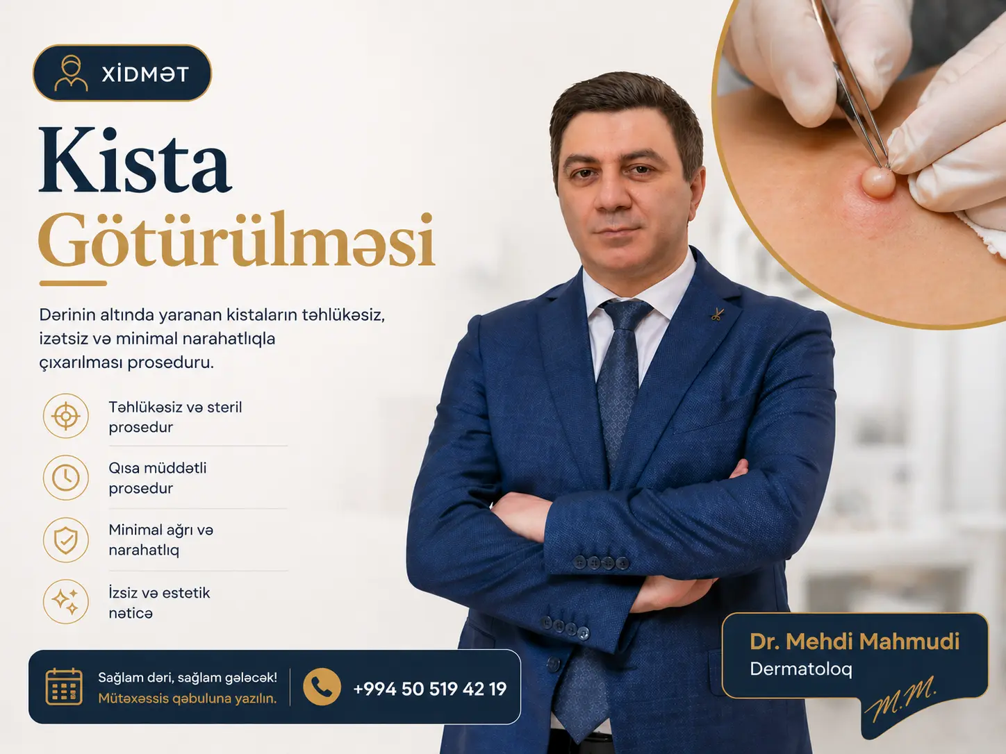 Kista Götürülməsi — Dr. Mehdi Mahmudi
