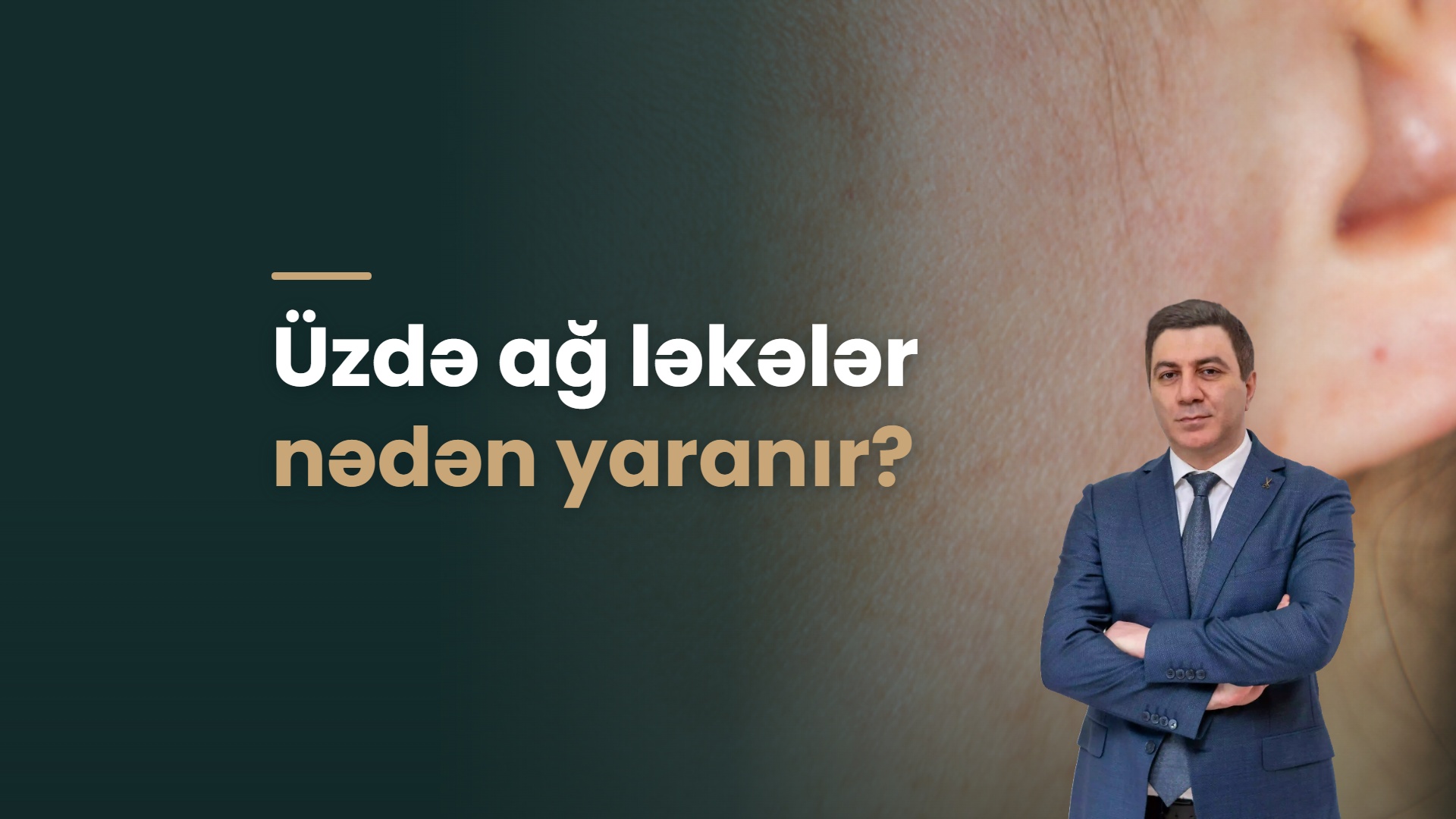 Üzdə ağ ləkələr nədən yaranır?