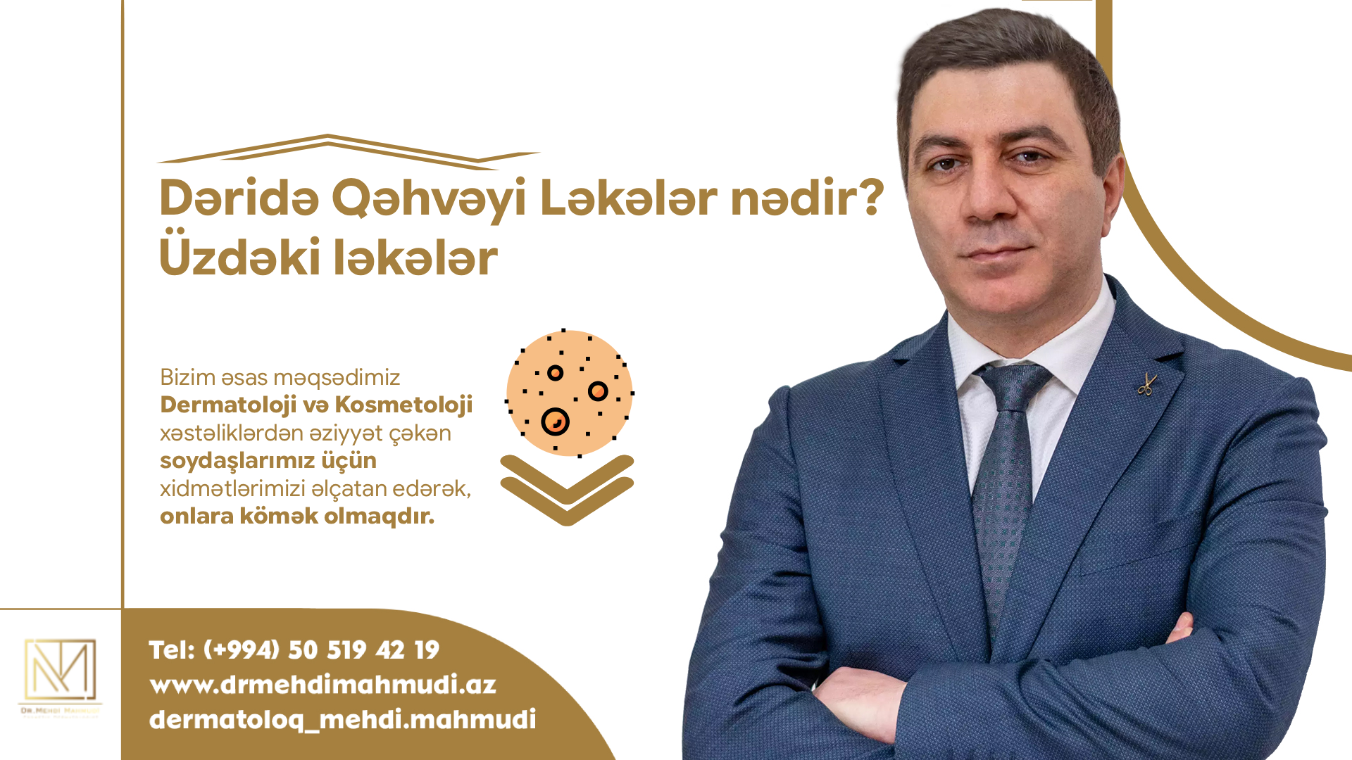 Dəridə Qəhvəyi Ləkələr | Müalicəsi varmı? - 2026